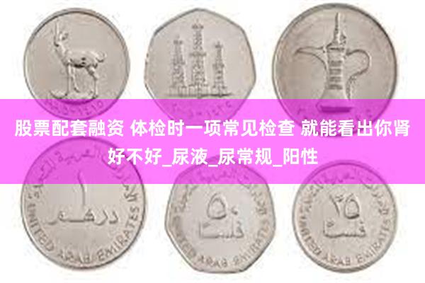 股票配套融资 体检时一项常见检查 就能看出你肾好不好_尿液_尿常规_阳性
